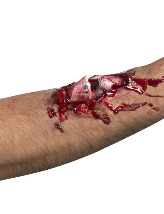 Fausse blessure os cassé